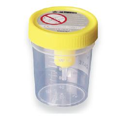 CONTENITORE URINA STERILE MEDIPRESTERIL CON SISTEMA TRANSFERT PER PROVETTE SOTTOVUOTO - Newepa Srl